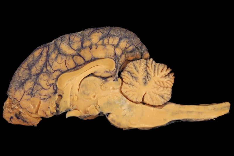 Découverte 2026 : comment la substance blanche du cerveau influence notre cognition